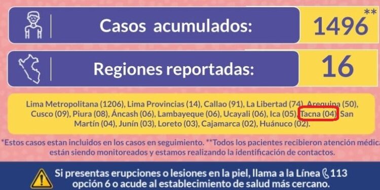 Atentos viajeros: Cuarto caso positivo de viruela del mono en Tacna